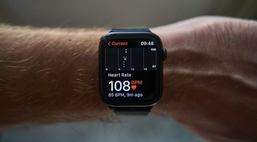 Smartwatch